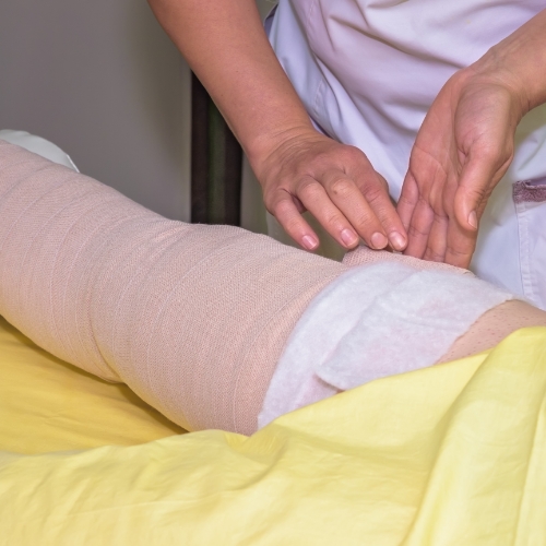 Physical-therapy-lymphedema-lamesa-physical-therapy-&-sports-rehab-lamesa-tx